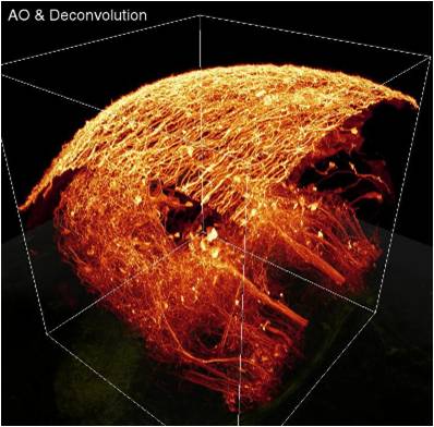 Imagerie à deux photons avec optique adaptative  et déconvolution